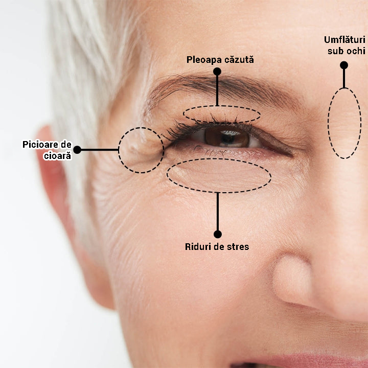 clinical-skincare-instant-eye-tightener