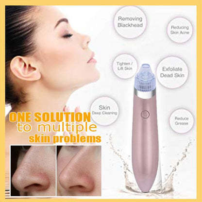 Instrument de frumusețe pentru liftingul facial