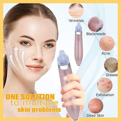 Instrument de frumusețe pentru liftingul facial